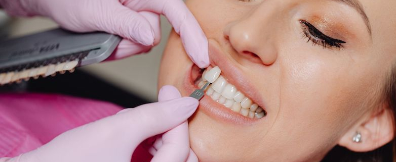 Masterclass esthétique dentaire - Analyse esthétique et facettes céramiques
