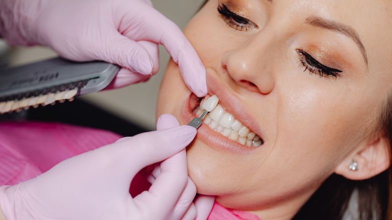 Masterclass esthétique dentaire - Analyse esthétique et facettes céramiques