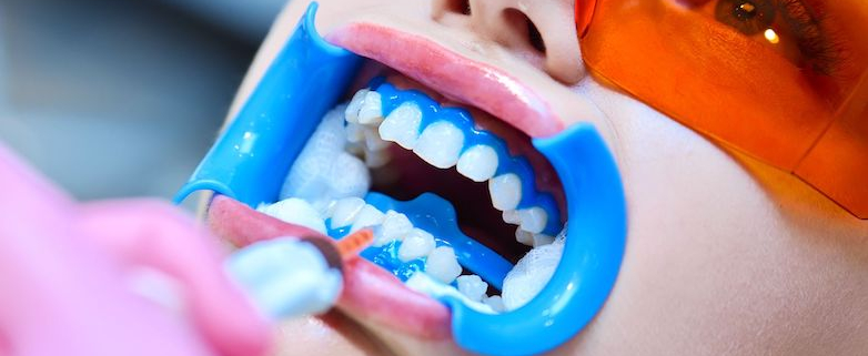 Masterclass esthétique dentaire - Éclaircissement et taches blanches