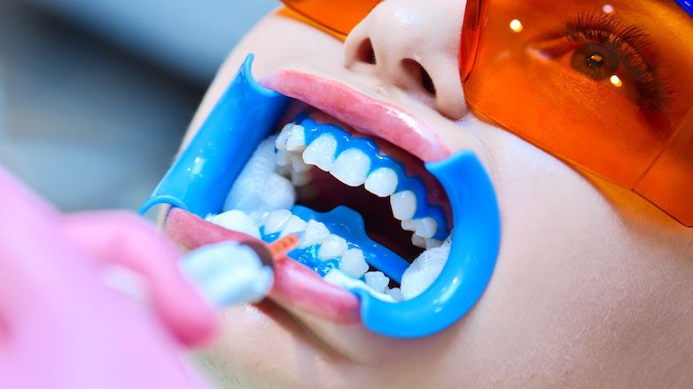 Masterclass esthétique dentaire - Éclaircissement et taches blanches