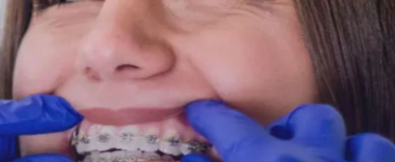 Formation orthodontie - Module 2 - Croissance, traitement hybride et haute technologie